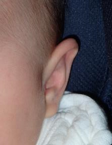 ear39