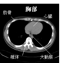 写真　胸部CT画像